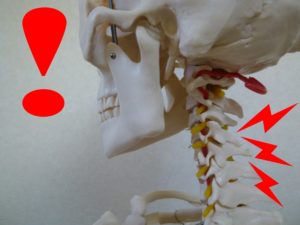 首が痛い、頚椎損傷